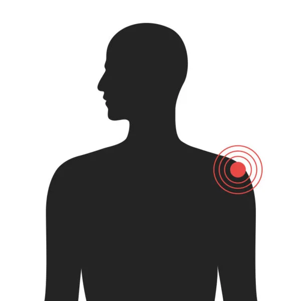 Axlir - Algeng meiðsli - Sjúkraþjálfun Kópavogs