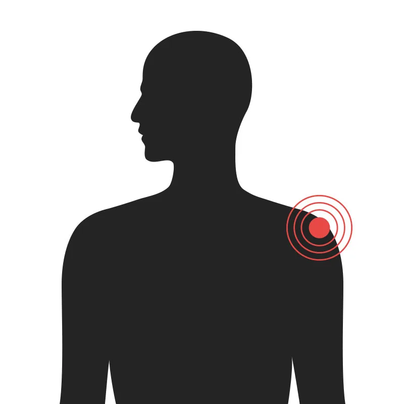 Axlir - Algeng meiðsli - Sjúkraþjálfun Kópavogs