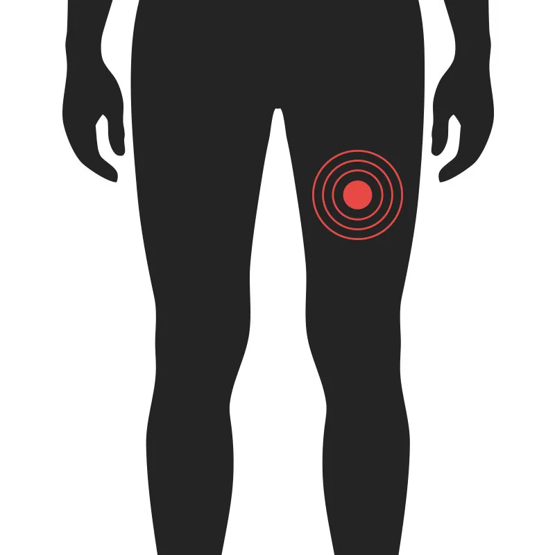 Fótleggur - Algeng meiðsli - Sjúkraþjálfun Kópavogs