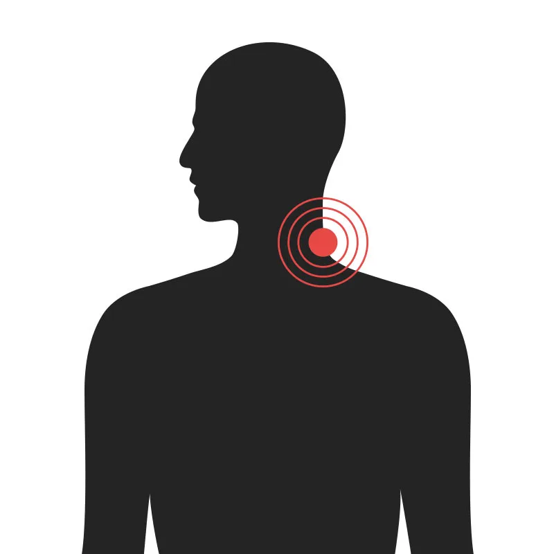 Háls - Algeng meiðsli - Sjúkraþjálfun Kópavogs