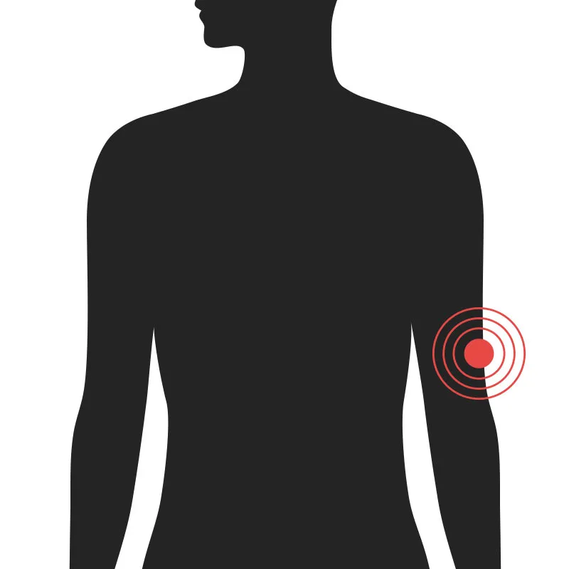 Handleggur - Algeng meiðsli - Sjúkraþjálfun Kópavogs