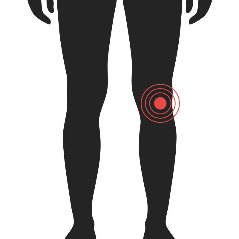 Hné - Algeng meiðsli - Sjúkraþjálfun Kópavogs