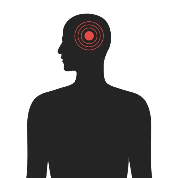 Höfuð - Algeng meiðsli - Sjúkraþjálfun Kópavogs