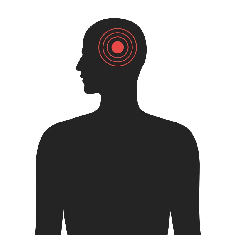 Höfuð - Algeng meiðsli - Sjúkraþjálfun Kópavogs