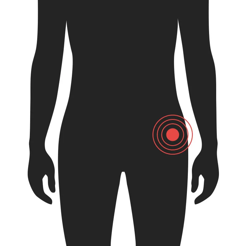 Mjöðm - Algeng meiðsli - Sjúkraþjálfun Kópavogs