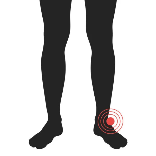 Ökkli - Algeng meiðsli - Sjúkraþjálfun Kópavogs